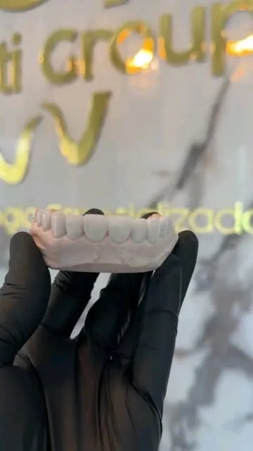 Prótesis dental
